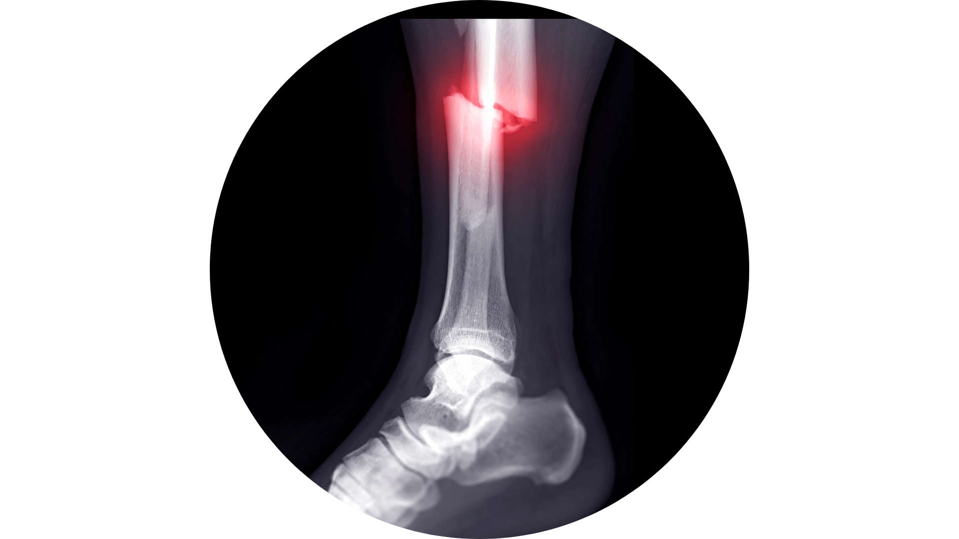 Knochenbrüche & Gelenkverletzungen