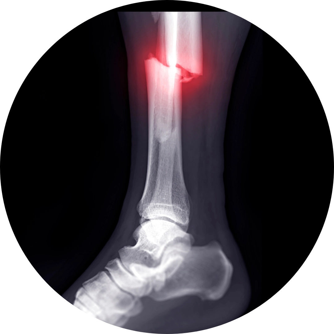 Knochenbrüche & Gelenkverletzungen