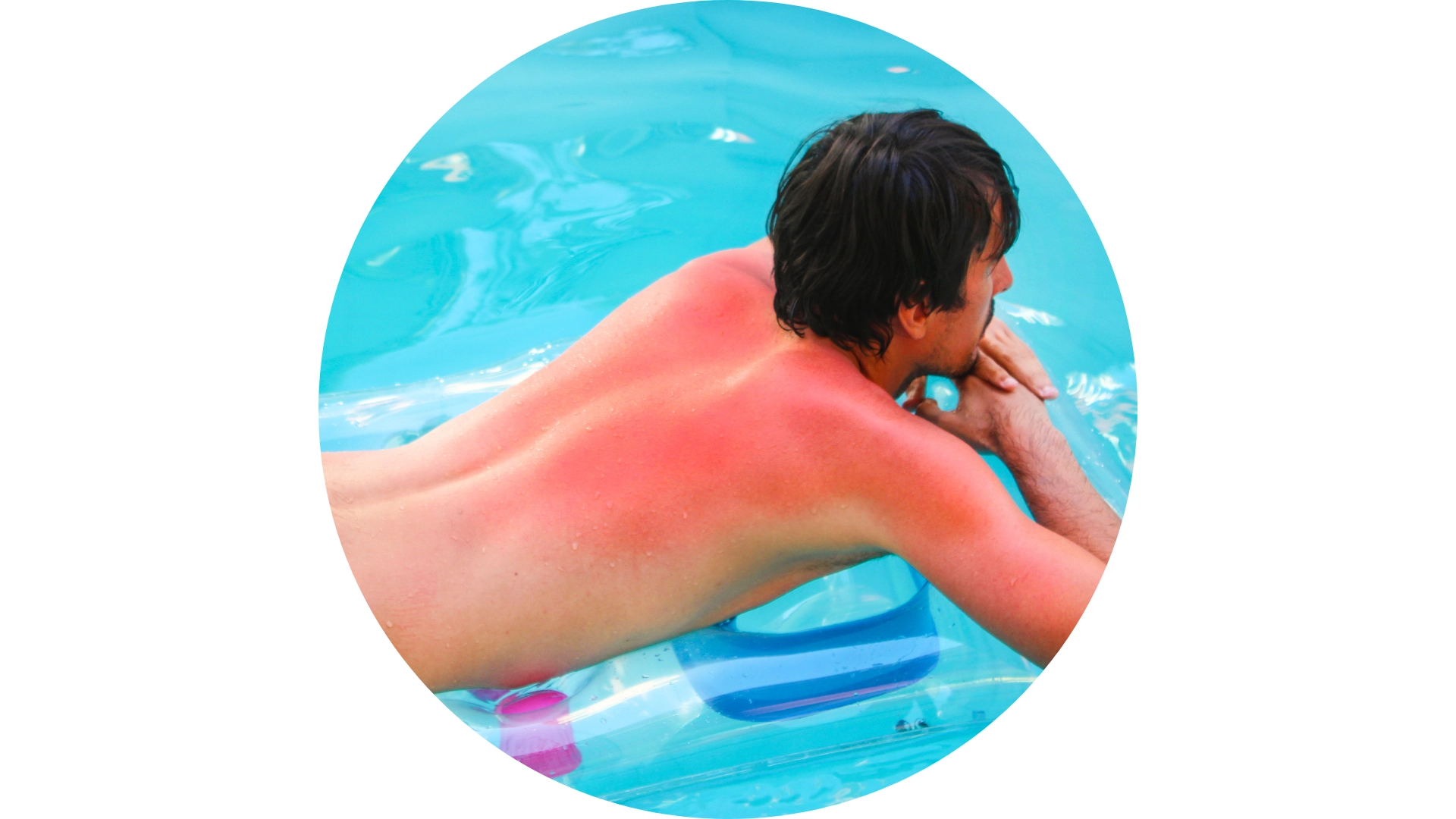 Verbrennungen & Verätzungen